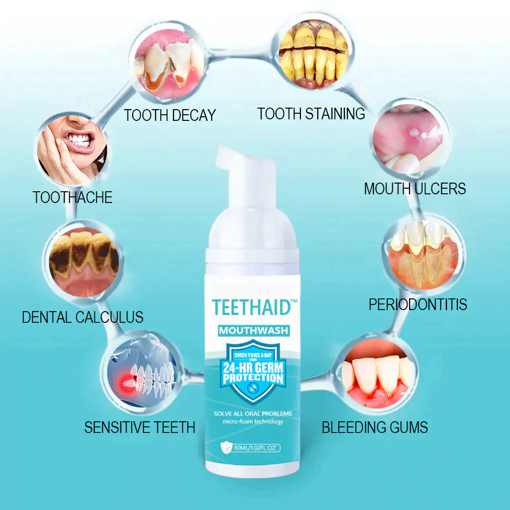 Teethaidâą đ„đ„Mouthwash, Calculus Removal, Teeth Whitening, Healing Mouth Ulcers, Eliminating Bad Breath, Preventing and Healing Caries