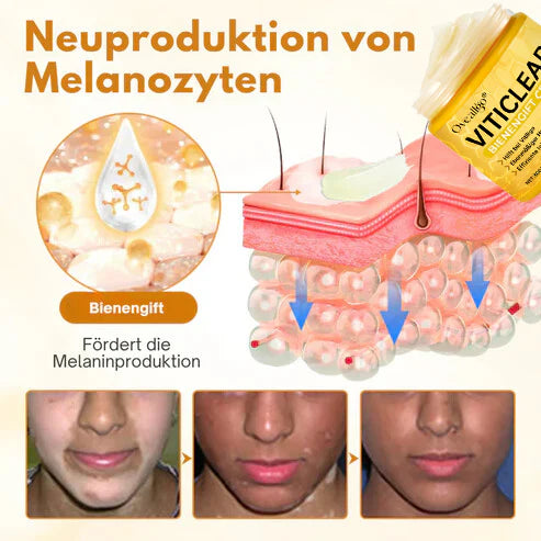 Fivfivgo® VitiClear Pro Bienengift Creme