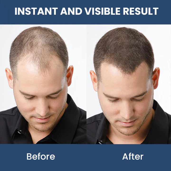 Hair Thickening Ginger Essence Spray